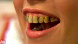 Nicotine Tooth FX